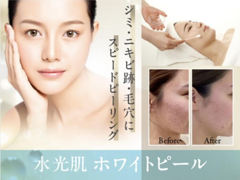 thumbnail_image